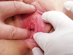 Blond female real gyno check up